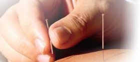 acupuncture for better health dr. ryan hatch certified acupuncturist parker co