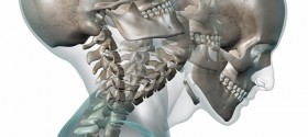 headache neck pain back pain relief with chiropractic treatments
