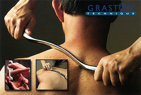 Graston technique for chiropractors